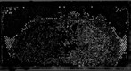 Healthy Progression July 14 Depth-map