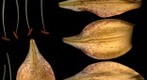 Lily Dissection