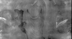 Infrared Reflectography (IRR)