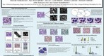 whereRU: Aresty Poster 108- EMaGACOR - Automated Lymphocyte Segmentation on BC histopathology images