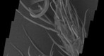 Spider Mite Foot