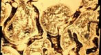 Bone sample