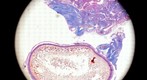 developing egg and yolk
