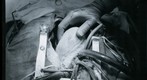 Photo of 35mm Black and White Negative of a Heart Surgery Photo