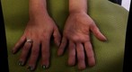 Rose's hands, a view