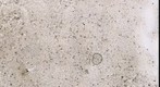 145-881A-1H-01-120cm