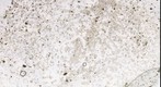 145-881A-1H-01-20cm