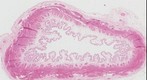 Gigahistology - Gall Bladder