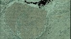 Thin Section Photo of Garnet-Chloritoid Schist
