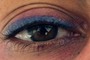 And the other eye
