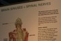 Informational display