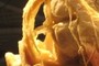 Dural Sinuses