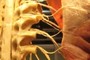 Peripheral Nerves