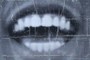 Teeth of Shayaa