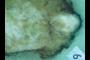 Tissue Image