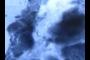 Microcalcifications