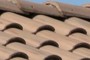 Shingles