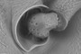 antennal fossa