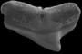 Upper posterior