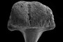 Symphyseal tooth
