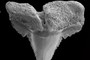 Anterior tooth
