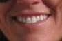 Beautiful Smile