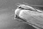 Exoskeletal Knee