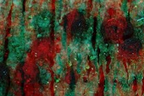 145536-210x140