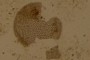 Broken Diatom
