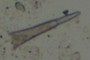 Radiolarian Spiracle