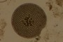 Diatom