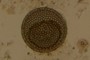 Diatom