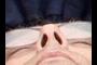 Nostrils 2