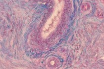 175704-210x140