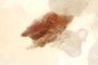 Beetle Fragment
