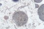 Diatom