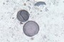 Diatoms
