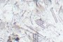 Spiracles