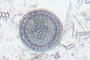 Diatom