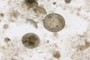 Diatoms
