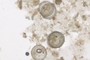 Diatoms