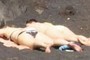 Sunburn