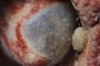 crab eye