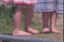 Legs