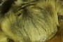 Pronotum