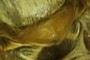 Scutellum