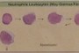 Neutrophile Leukozyten