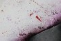 bloody