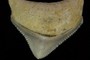 Posterior 2